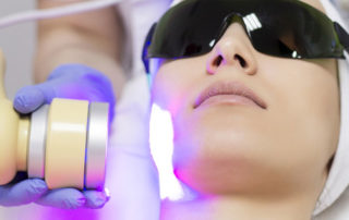Laser Treatment