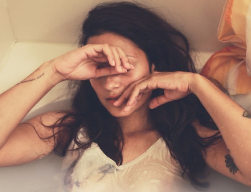 Melasma